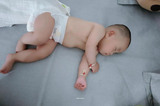 湘潭六个月宝宝眼睛散光